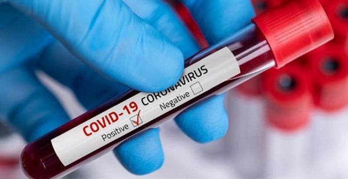 Mantan Wabup Positif Covid-19