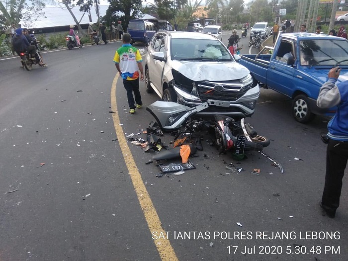 Tabrak Terios, Mahasiswa Patah Kaki