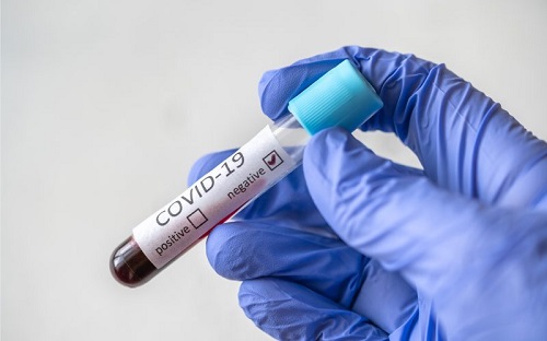 Swab 6 Staf Negatif Covid-19