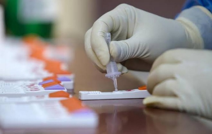 Dinkes Siapkan Swab Antigen dan Vaksin, Untuk Peserta Tes P3K