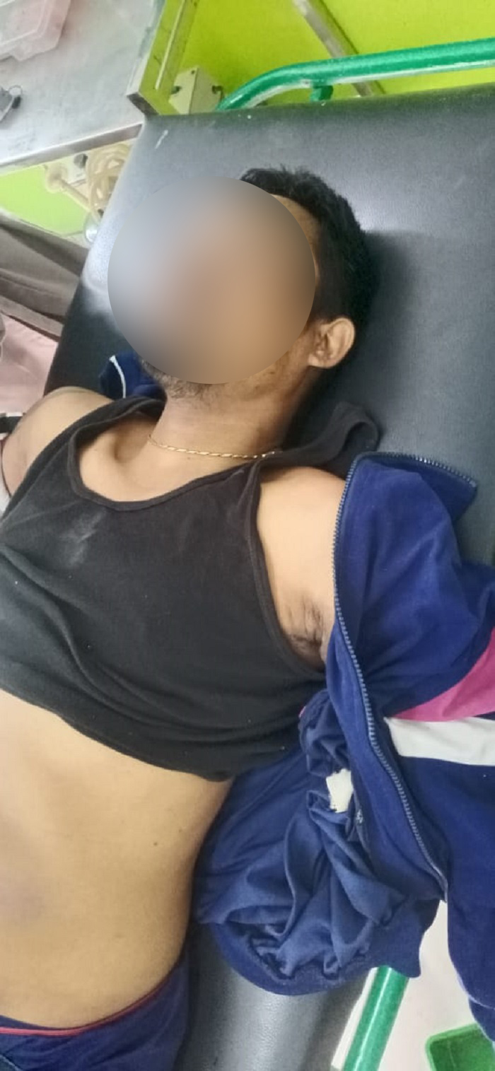 Begal Tewas Usai Ditembak Polisi, Pelaku Residivis 6 Kali Masuk Lapas