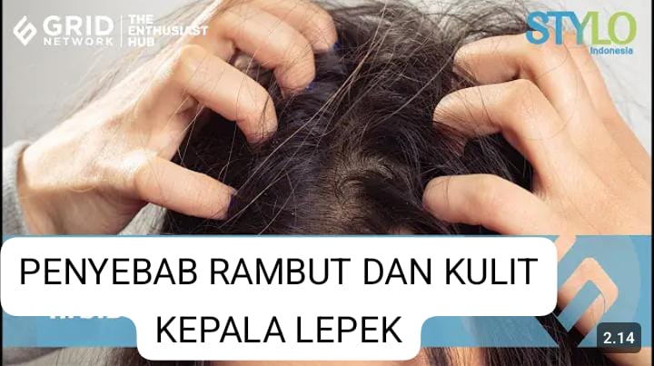 Rambut dan Kulit Kepala Cepat Bau? Ini Penyebab yang Sering Tak  Disadari!