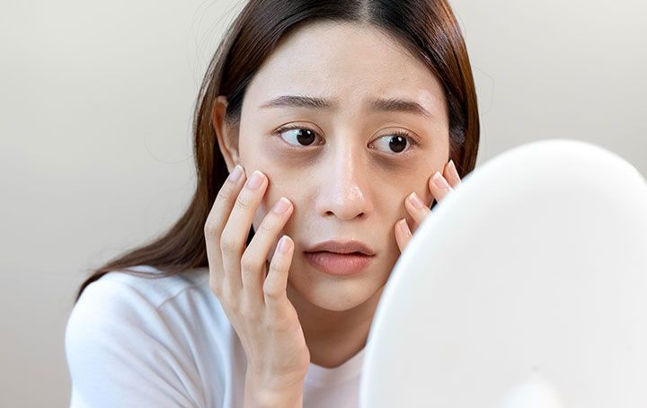  Mata Panda Saat Ramadan? Ini Penyebab dan Solusi Ampuhnya