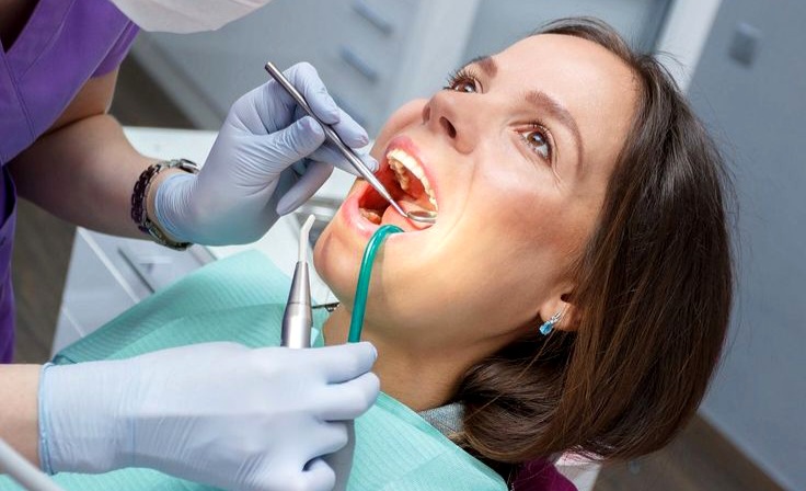 Karang Gigi Membandel? Ini Penyebab, Solusi, dan Cara Mencegahnya
