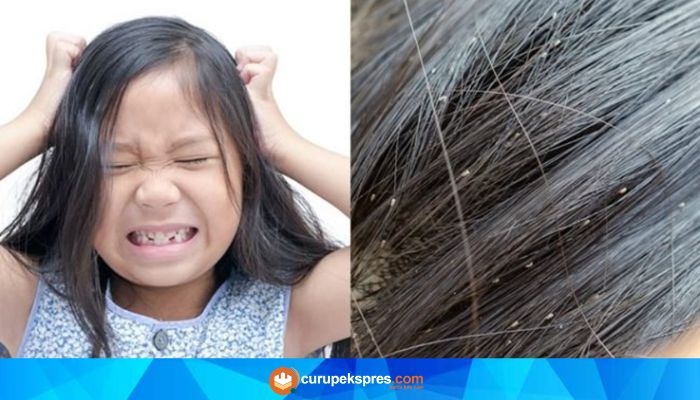 Menghilangkan Kutu di Rambut: 12 Tips Mudah yang Dapat Dilakukan di Rumah