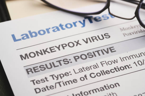 Pernah Mendengar Cacar Monyet? Ternyata Ini Gejala Mongkeypox Virus !!