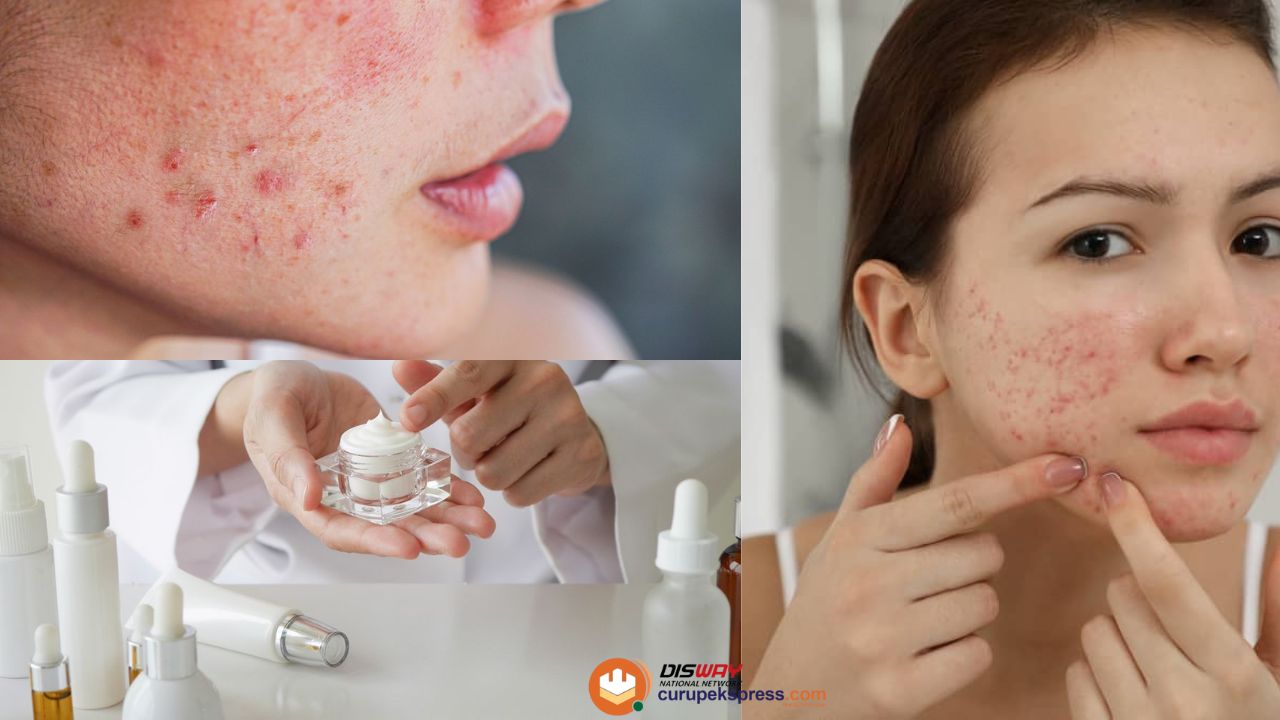 Waspada! Efek Samping Menggunakan Skincare dengan Kandungan Merkuri