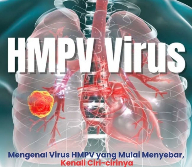 Soal Virus HMPV Sudah Masuk Indonesia, Ini Penjelasan Kemenkes RI