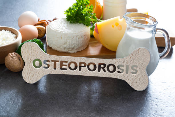 Cara Alami Mengatasi Osteoporosis Agar Lebih Bugar Tanpa Masalah Tulang