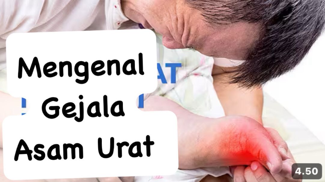 Mengenal Gejala Penyakit Asam Urat