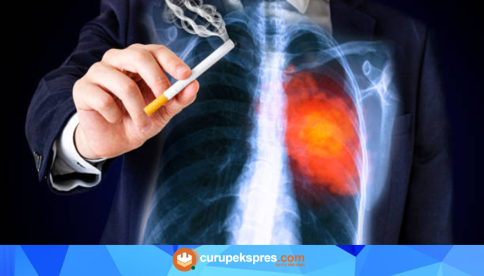 Ngeri! Inilah Organ Tubuh yang Paling Cepat Rusak Akibat Merokok