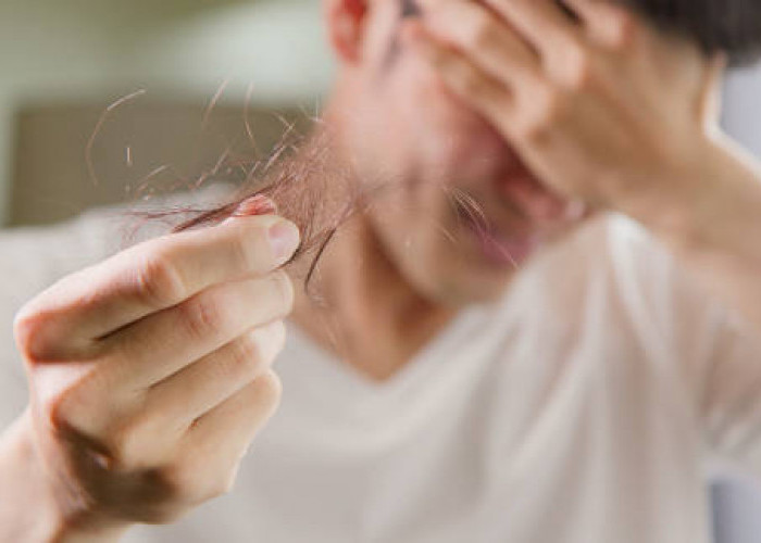 Rambut Rontok Pada Pria: Penyebab dan Cara Mengatasinya