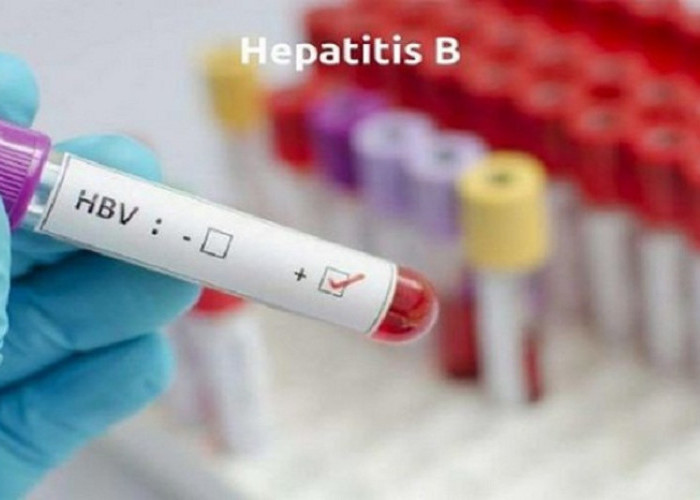 Waspada.. 20 Bumil Terjangkit Hepatitis