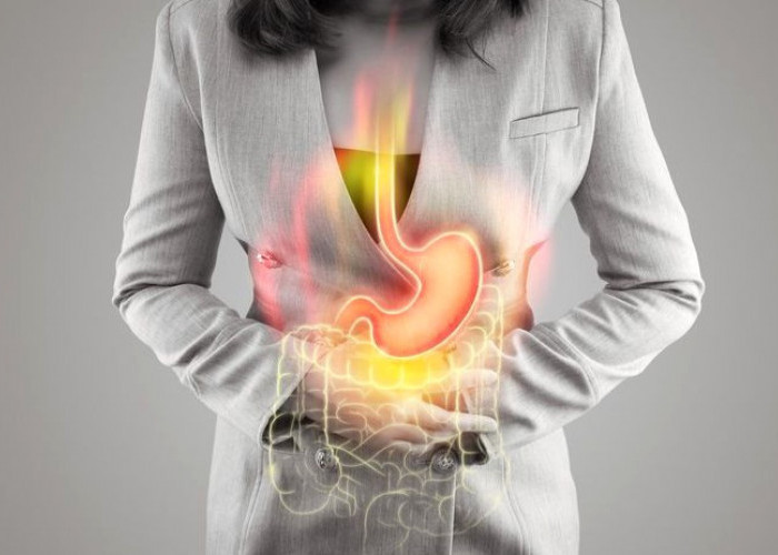 Rahasia Puasa Nyaman bagi Penderita GERD Tanpa Gangguan Asam Lambung