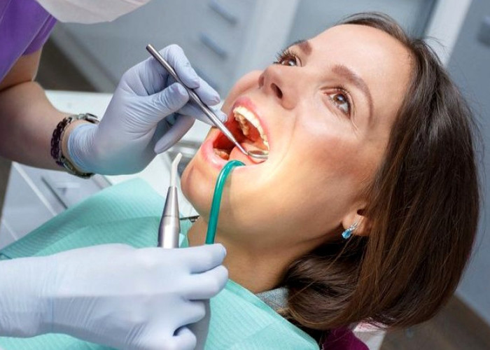 Karang Gigi Membandel? Ini Penyebab, Solusi, dan Cara Mencegahnya