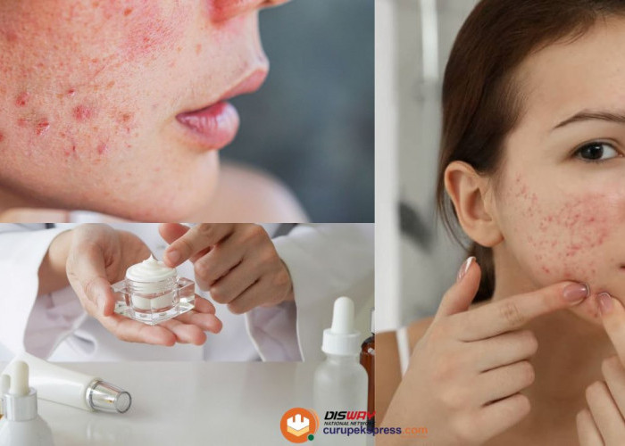 Waspada! Efek Samping Menggunakan Skincare dengan Kandungan Merkuri