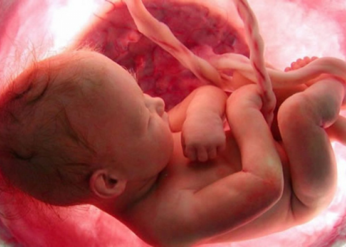Membedakan Gejala Kehamilan Kembar dan Kehamilan Normal: Apa yang Perlu Anda Tahu?