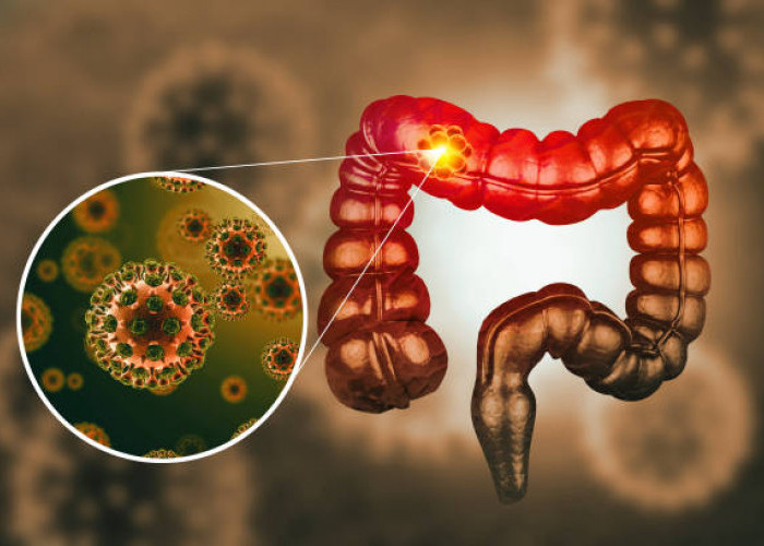 Faktor yang Mempengaruhi Metabolisme Tubuh