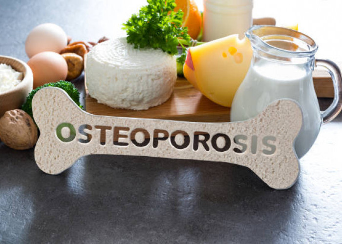 Cara Alami Mengatasi Osteoporosis Agar Lebih Bugar Tanpa Masalah Tulang