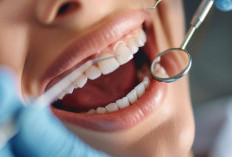 Bukan Sekadar Cantik, Senyum Sehat Jadi Kunci Pesona Perempuan Masa Kini