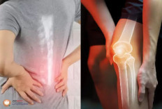  7 Makanan Pemicu Osteoporosis, Wajib Dihindari