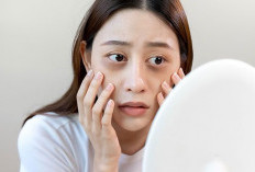  Mata Panda Saat Ramadan? Ini Penyebab dan Solusi Ampuhnya