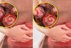 Cara Mengatasi Cacingan, Cek Disini!