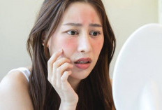  Bikin Kaget ! BPOM Umumkan 26 Skincare Berbahaya yang Banyak Dipakai